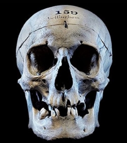 skull of James Bellingham